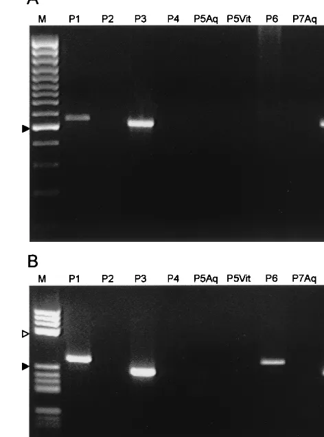 FIG. 4. (A) First PCR (ITS1-ITS4 primer pair) from different oc-ular samples. M, ladder marker GeneRuler 100bp DNA Ladder Plus