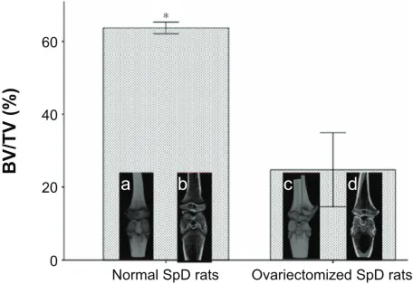 Figure 7 m-cT analysis of normal and ovariectomized rats before implantation.Notes: BV/TV for the tibia compartment in the knee joint was used to identify relative changes in BV density