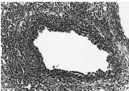 FIG. 3. Bronchiole in the lung of a pig inoculated with both M. hyopneumoniaewith and SIV