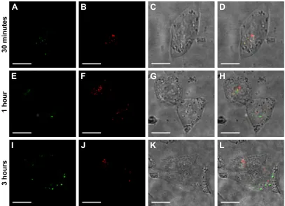 Figure 6 escape of Fa-FITc-MsNs from endolysosome compartments.Notes: hela cells were treated with 100 μg/ml of Fa-FITc-MsNs for 30 minutes, 1 hour, or 3 hours