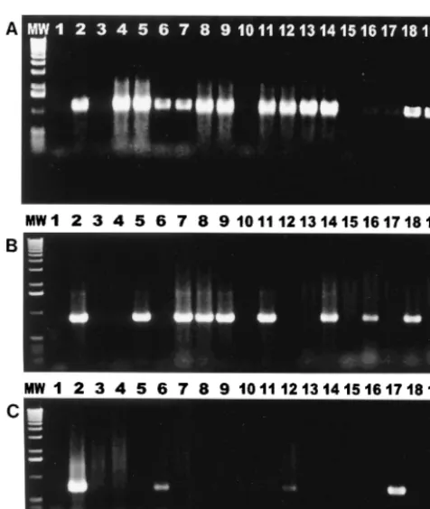FIG. 3. Products (1.2 kb) of PCR using Helicobacterprimers were digested byVisigel matrix