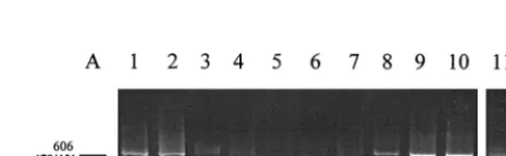 TABLE 2. Genotype analyses based on the line probe assay andthe 5� NC sequence of the U.S