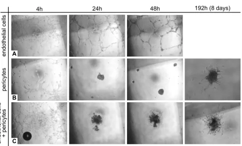 Figure 3.3: Pattern formation in vasculogenesis assays with endothelial cells (A), pe- pe-ricytes (B), or endothelial cells and pepe-ricytes at a ratio of 2:1 (C).