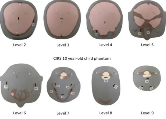 Figure 12B. Child ATOM Slices with machined OSL dosimeter locations  