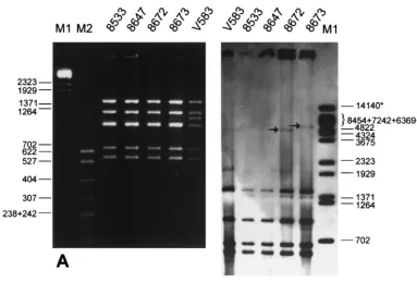 FIG. 2. RFLP analysis of vanBLanes M1,gene cluster probe. The arrows indicate DNA bands that distinguished the two polymorphs of the region