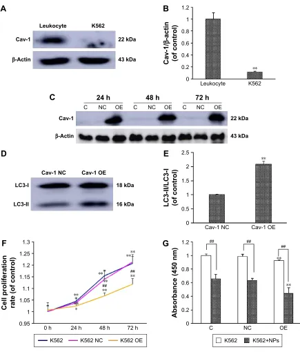 Figure 6 Overexpression of caveolin-1 increases K562 cell sensitivity to realgar NPs.Notes: (A) The expression of caveolin-1 in rat leukocytes and K562 cells