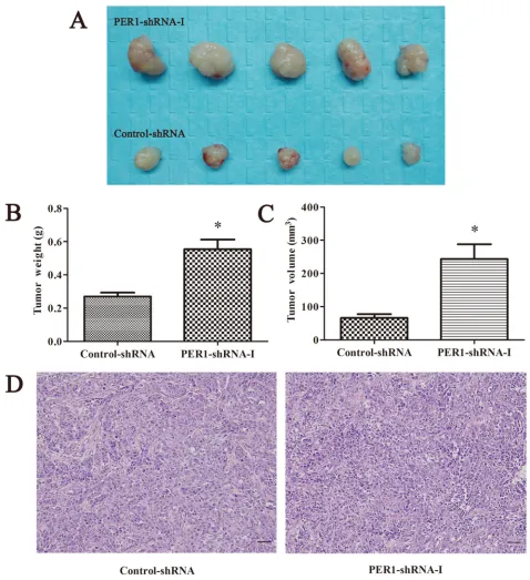 Figure 4: PER1 knockdown enhances the tumorigenic capacity of SCC15 cells in vivo. A. The condition of tumorigenesis in vivo including PER1-shRNA-I and Control-shRNA group cells