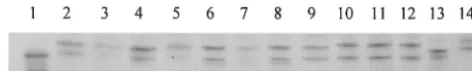 FIG. 2. SSCP analysis of Stype); lane 2, L400 (pattern II); lane 3, L575 (pattern II); lane 4, L522(pattern II); lane 5, L378 (pattern II); lane 6, L471 (pattern III); lane7, L607 (pattern III); lane 8, L537 (pattern III); lane 9, L574 (patternIV); lane 10