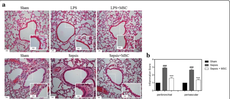 Fig. 1 Mice treated with MSCs showed a reduced inflammation score in the lung.represent the mean ± SEM, a Lung sections were subjected to H&E staining