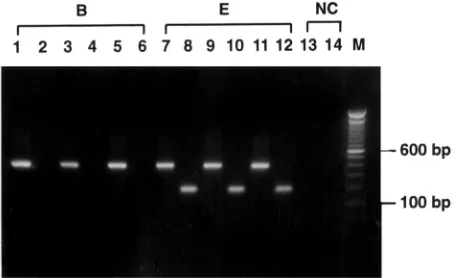 FIG. 1. Detection of subtype E virus by the subtype E PCR assay.HIV-1 proviral DNA extracted from three samples each of subtypes B