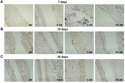Figure 6 Positive expression degree of vimentin as analyzed by immunohistochemistry after implantation of silicone rubber materials