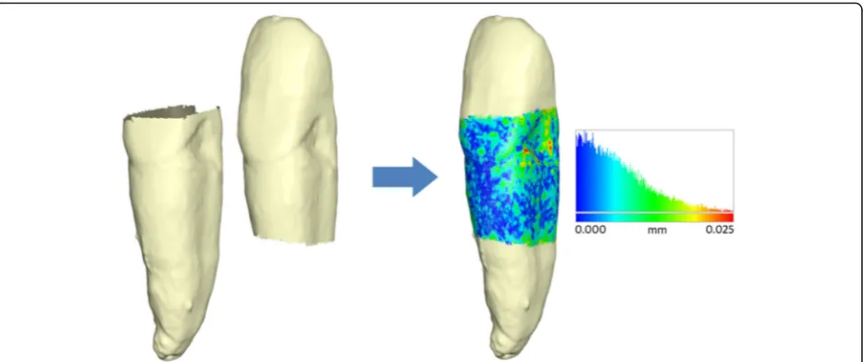 Fig. 2 Superimposition of the tooth model on the digital cast, usingthe crown for alignment