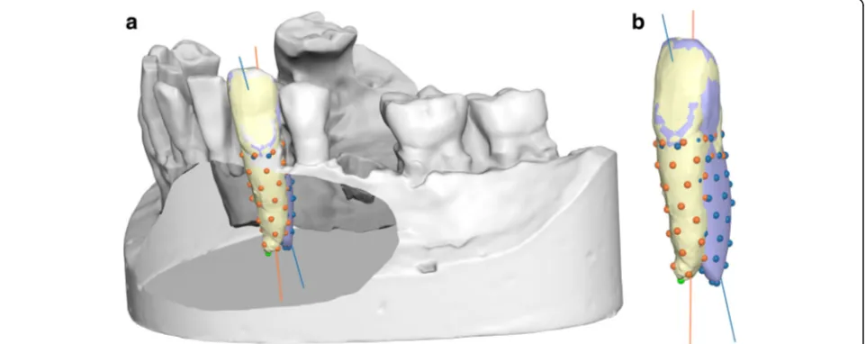 Fig. 3 Superimposition of the teeth and roots, as estimated by thesoftware, on the digital cast