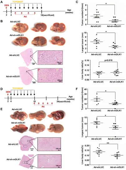 Figure 4: Adenovirus-mediated mouse Dlk1 knockdown attenuates HCC progression. (A–C) The effect of early  adenovirus-mediated DLK1 knockdown on DEN-induced mouse HCC tumors