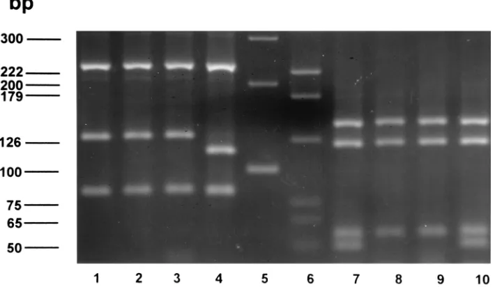 FIG. 1. FL-HPLC patterns of three strains of M. mageritense andtwo rapidly growing mycobacterial reference strains.
