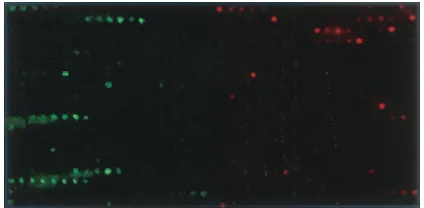 TABLE 3. IS6110 insertion sites in the examinedstrains and isolates