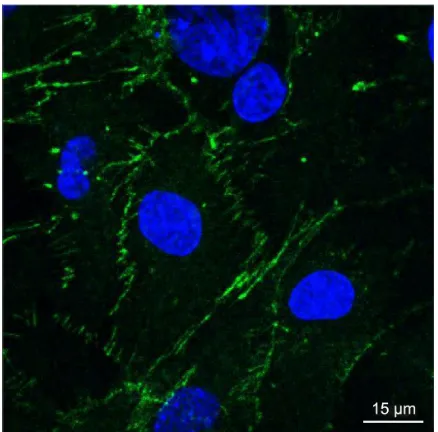Figure 8 Permeability of the sPIONs across the BBB model.Notes: Data are shown as the mean ± sD; N=3, *P0.05 compared with ggB.Abbreviations: BBB, blood–brain barrier; BPc, bovine serum albumin, polyethylene glycol, and collagen; cPB, collagen, polyvinyl alcohol, and bovine serum albumin; ggB, glycine, glutamic acid, and bovine serum albumin; ggc, glycine, glutamic acid, and collagen; ggP, glycine, glutamic acid, and polyvinyl alcohol; sD, standard deviation; sPION, superparamagnetic iron oxide nanoparticle.