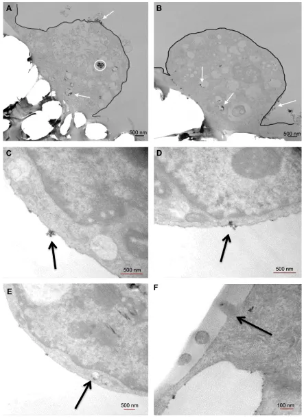 Figure 9 TeM thin sections of cell uptake of sPIONs. Notes: (A) Cell uptake of CPB; magnification 3,000×
