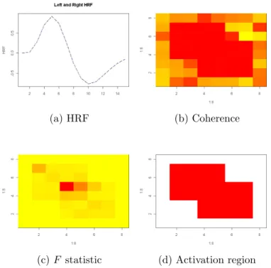Figure 4.7: Detecting the activation regions by TFE. The activation region is where the brain has response to the experiment stimulus