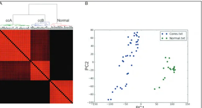 Figure 2.3 Two ccRCC subtypes are distinct from normal kidney tissue. 