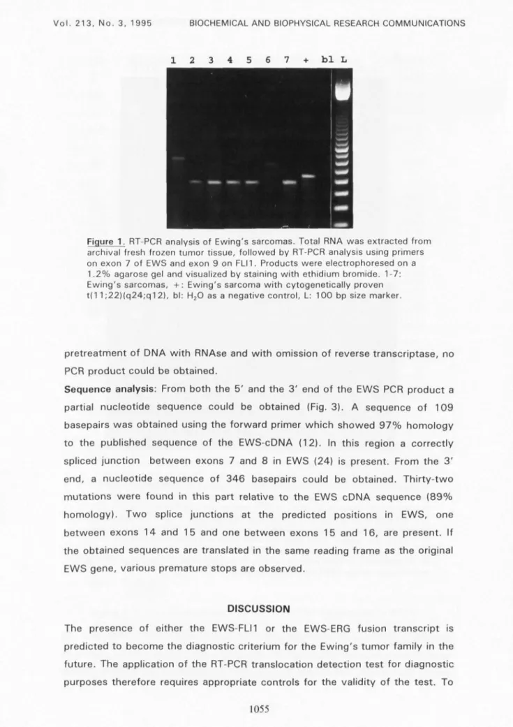 Figure 1. RT-PCR analysis of Ewing's sarcomas. Total RNA was extracted from archival fresh frozen tumor tissue, followed by RT-PCR analysis using primers on exon 7 of EWS and exon 9 on FLU