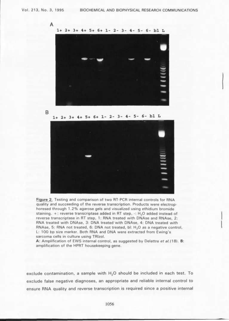 Figure 2. Testing and comparison of two RT-PCR internal controls for RNA quality and succeeding of the reverse transcription