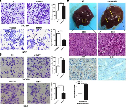 Figure 2: DMBT1 represses GBC cell migration and invasion in vitro and in vivo. (A–B) Knockdown of DMBT1 enhanced the GBC-SD and NOZ cell migration and invasion