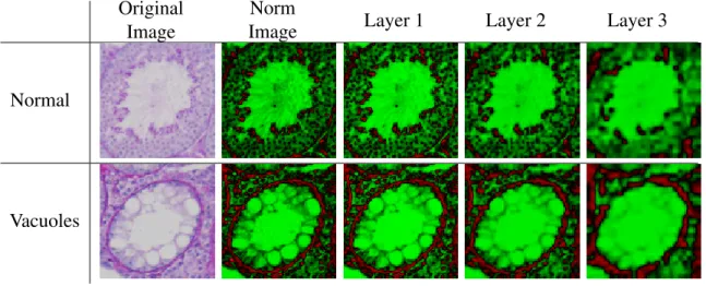 Table 3.5: Examples of reconstructed images generated from the deconvolutional networks by taking the hidden representation of the particular layer and cascading it back to the original image.
