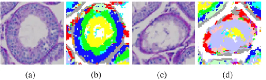 Figure 4.1: (a)(c) Examples of true-color testis histology cross sections of normal and abnormal tubules