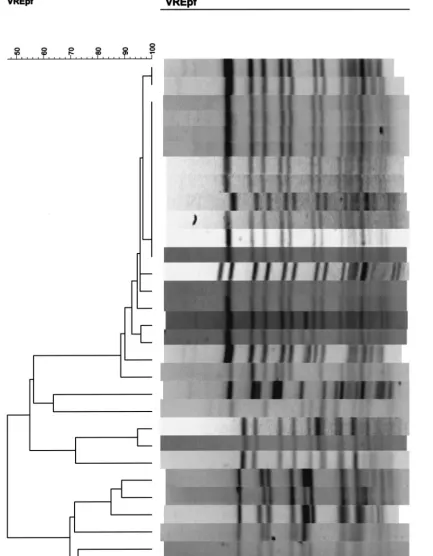 FIG. 1. PFGE patterns of VREF isolates from 30 patients. Lanes marked by asterisks represent isolates belonging to the outbreak strain; theremaining lanes represent isolates belonging to nonepidemic strains.