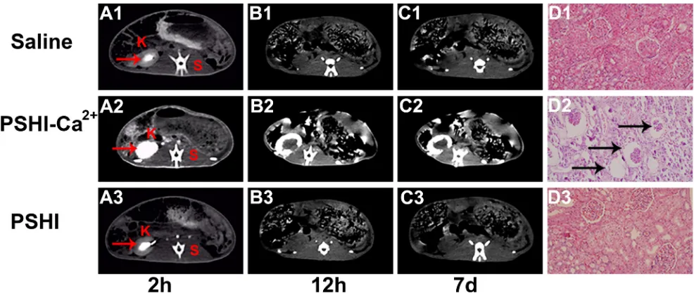 Figure 5: CT scans of normal rabbits at predetermined intervals after embolization using saline (A1-C1), PSHI-Ca2+(A2-C2) and PSHI (A3-C3)
