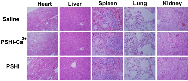 Figure 6: DSA images of VX2 liver tumors in rabbits after embolization with saline (B1), PSHI-Ca2+ (B2) and PSHI (B3), A1, A2 and A3 are DSA images before embolization