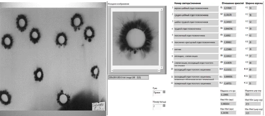Fig. 2. An example of the analysis of the brightness of sectors of the crown thumb  