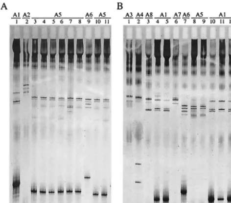 FIG. 1. ospC277-bp fragment of the central variable part of the SSCP patterns of 21 invasive B
