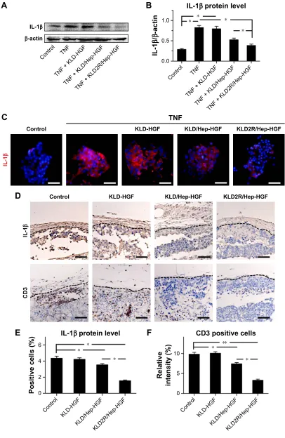 Figure 7 Effect of HGF-loaded SAP/Hep gel on inflammation of staining for Il-1mean Abbreviations:β-cell.Notes: (A, B) Western blot and quantitative analysis of Il-1β protein level in vitro