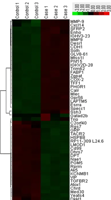 Figure 1. Heat map and cluster analysis of the 50 sion levels: Green represent low relative expression differentially expressed mRNAs in control and gastric cancer samples