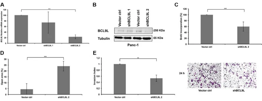 Figure 2: RNAi-mediated knockdown of BCL9L diminishes proliferation, migration and invasion of pancreatic cancer cells
