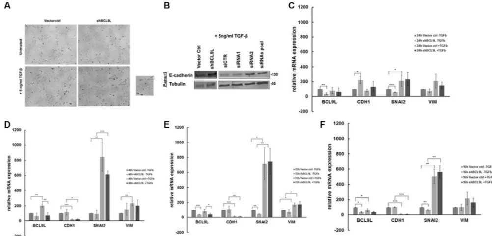 Figure 5: RNAi-mediated inhibition of BCL9L expression counteracts epithelial-mesenchymal transition in pancreatic cancer cells treated with TGF-β