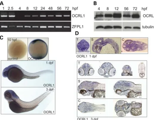 Figure 2. Developmental expression of zebrafish OCRL1. (A) RT – PCR of cDNA prepared at different embryonic developmental time points using primers against total OCRL1 and the control ZFPL1