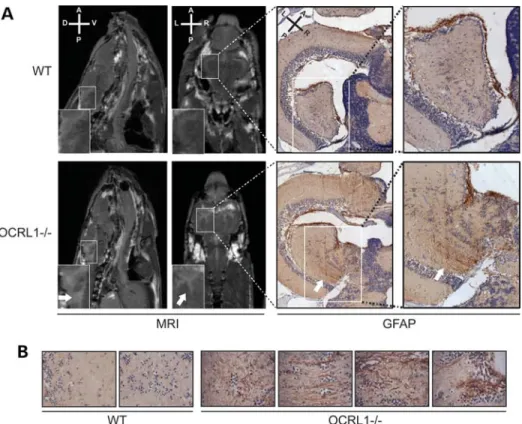 Figure 5. White matter lesions in OCRL1 mutant zebrafish. (A) Transverse relaxation (T2)-weighted MRI images of the brains of WT and OCRL12/2 adult zebrafish
