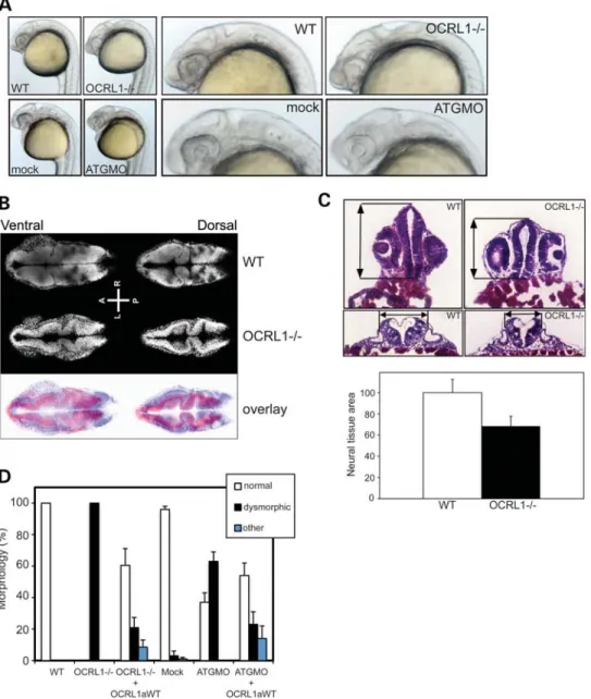 Figure 6. Impaired development of the brain and eyes in OCRL1-deficient embryos. (A) Representative bright field images of 26 hpf WT and OCRL12/2 uninjected embryos, or WT embryos injected with either mock or ATGMO morpholino