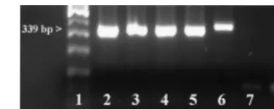 FIG. 1. Analysis of seminested PCR products (outer primer paironly) by 2% agarose gel electrophoresis and ethidium bromide stain-