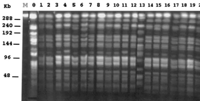 FIG. 4. PFGE proﬁles of Apa1 to 20,I-digested whole-cell DNA of 21 A. baumannii isolates