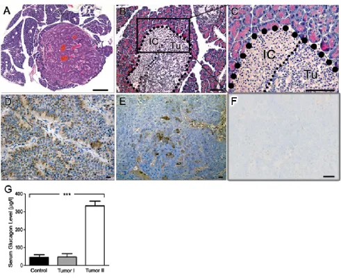 Figure 2: Immunohistochemistry reveals neuroendocrine origin of tumors in LSL-MYCN;hGFAP-Cre mice