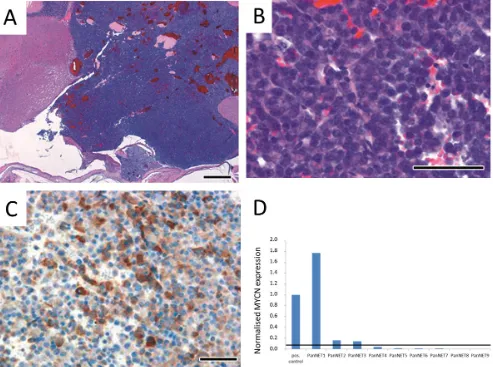 Figure 3: Immunohistochemistry of brain tumors in LSL-MYCN;hGFAP-Cre mice confirmed their neuroendocrine origin