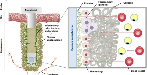 Figure 1.3.  The  foreign  body  response  to  a  percutaneous  glucose  sensor  upon  tissue implantation