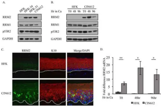 Figure 1. RRM2 protein and transcript levels are increased in HPV positive cells (A) Whole cell lysates harvested from undifferentiated human foreskin keratinocytes  (HFKs), HFKs stably maintaining HPV16 (HFK-16) or HPV31 (HFK-31) genomes, and  HPV31 posit