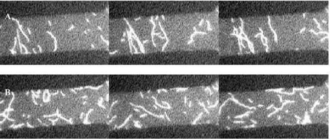 Figure 2.7. Epi fluorescent images of actin motility between quadrupole electrodes. One of  the four sections of adjacent electrodes is shown above