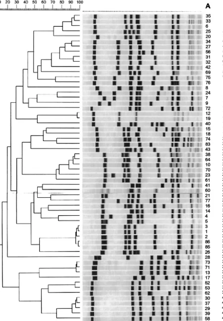 FIG. 1. Dendrogram of SmaI-PFGE of epidemiologically unrelated strains. Strain numbers are indicated in column A; PFGE types areindicated in column B.