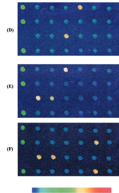 FIG. 5. Mycobacteriumanalysis was performed after ampliﬁcation of DNAs from cultured clinical specimens with primers F99 and R184T7, immobilization of speciﬁc(D)probes on a glass slide, and hybridization on the glass slide with Cy-5-labeled clinical specim